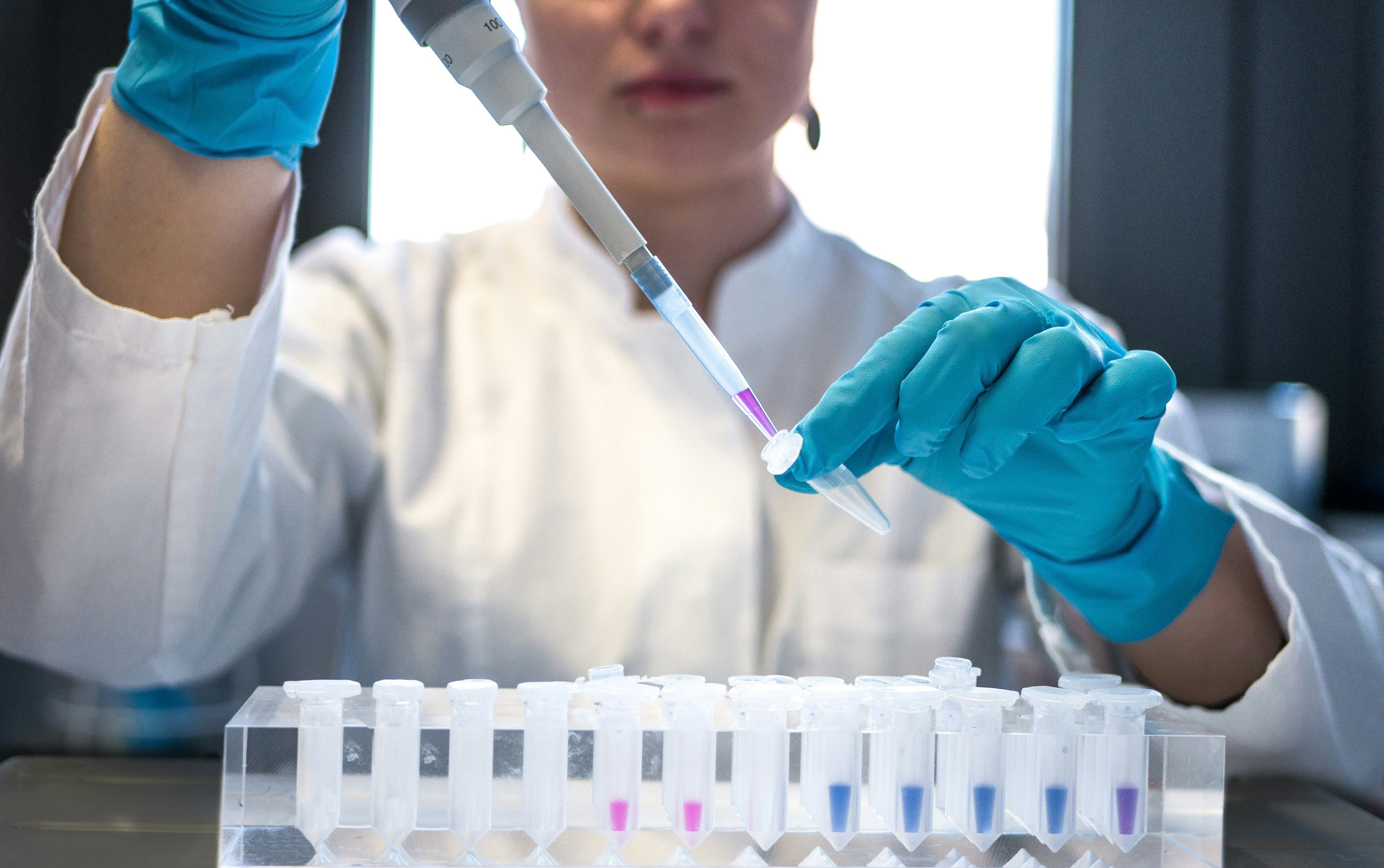 female laboratory worker with pipette