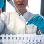 female laboratory worker with pipette